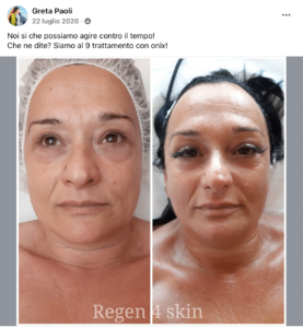 risultati estetiste con onix